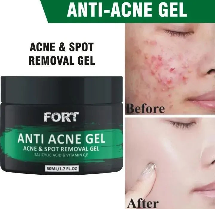Uptown La Acne Scar Removal Exfoliating Gel