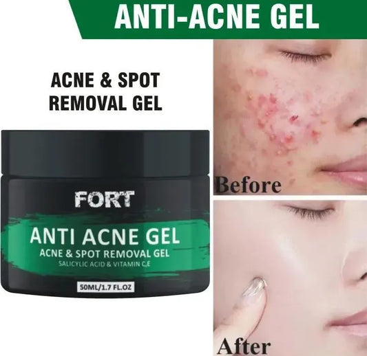 Uptown La Acne Scar Removal Exfoliating Gel